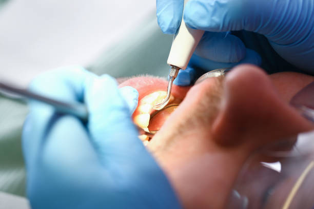 Best Emergency Broken Tooth Repair in Balmville, NY