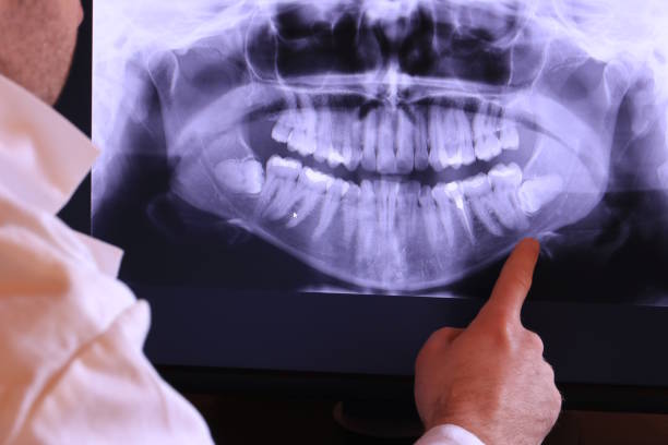 Best Emergency Treatment for Toothache in Balmville, NY